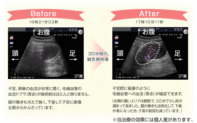 Before After
